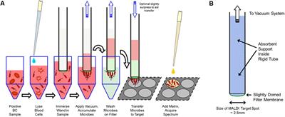 An Automated Sample Preparation Instrument to Accelerate Positive Blood Cultures Microbial Identification by MALDI-TOF Mass Spectrometry (Vitek®MS)